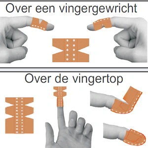 Pleisterkaart
